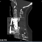 I have a screw loose.